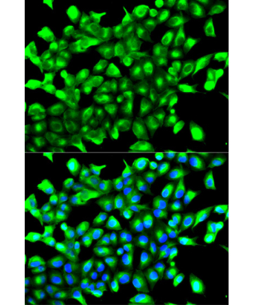 PHD2/EGLN1 Rabbit Polyclonal Antibody