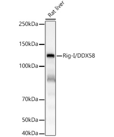 Rig-I/DDX58 Rabbit Monoclonal Antibody