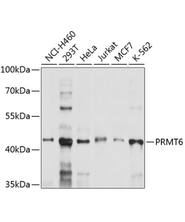 PRMT6 Rabbit Polyclonal Antibody