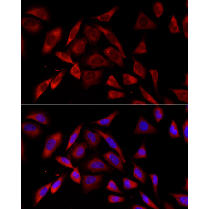 PKC alpha Rabbit Monoclonal Antibody