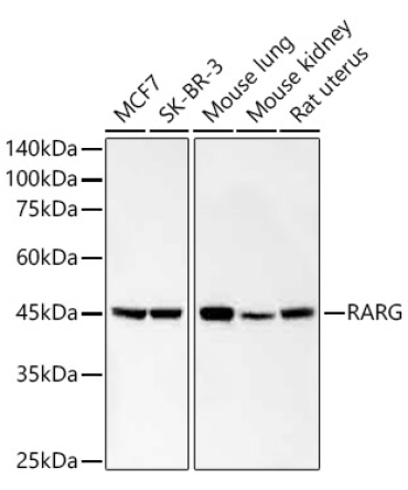 RARG Rabbit Monoclonal Antibody
