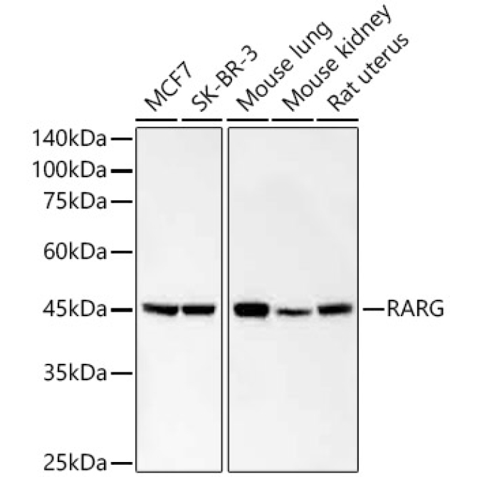 RARG Rabbit Monoclonal Antibody