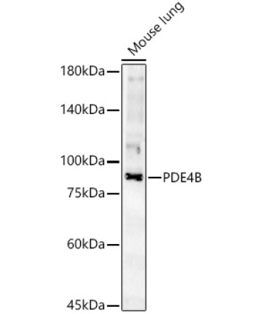 PDE4B Rabbit Polyclonal Antibody