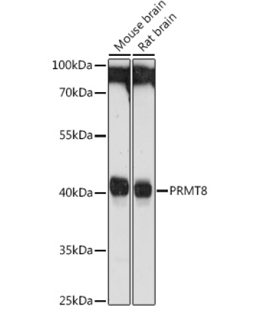 PRMT8 Rabbit Polyclonal Antibody