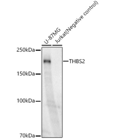 THBS2 Rabbit Monoclonal Antibody