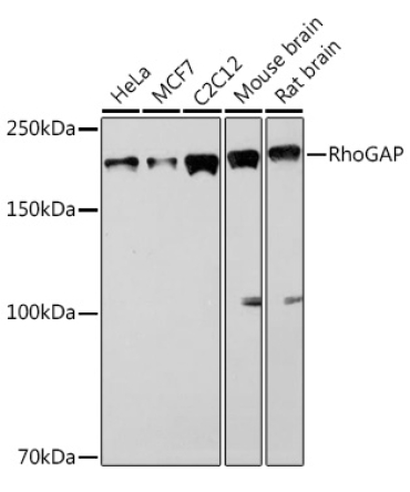 RhoGAP Rabbit Monoclonal Antibody