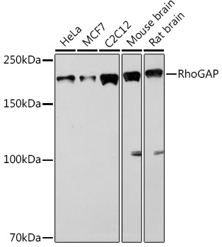 RhoGAP Rabbit Monoclonal Antibody