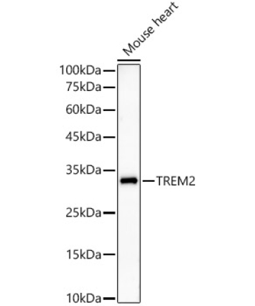 TREM2 Rabbit Monoclonal Antibody