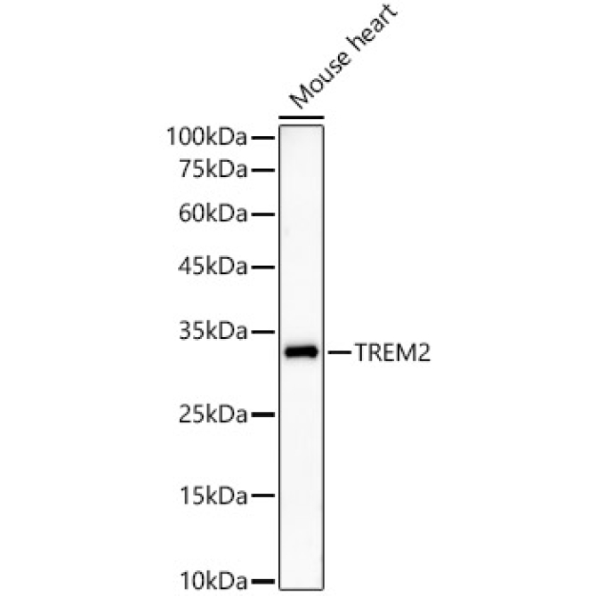 TREM2 Rabbit Monoclonal Antibody
