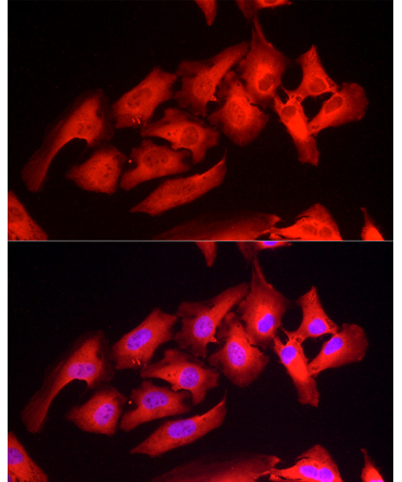 Peroxiredoxin 1/PAG Rabbit Polyclonal Antibody