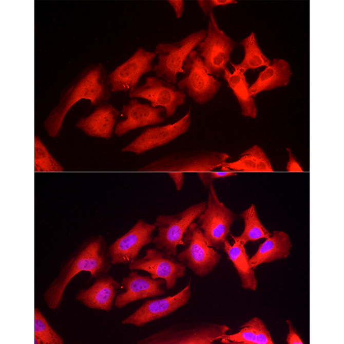 Peroxiredoxin 1/PAG Rabbit Polyclonal Antibody