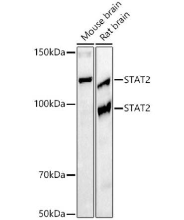 STAT2 Rabbit Monoclonal Antibody