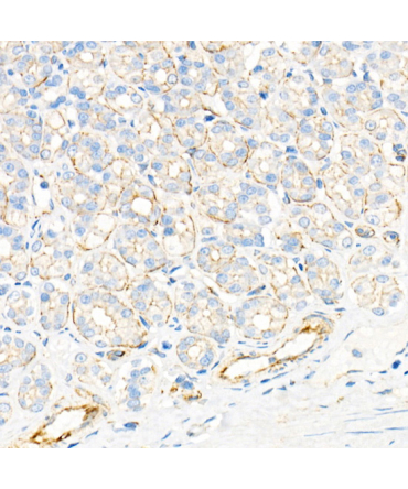 Plectin Rabbit Monoclonal Antibody