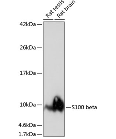 S100B Rabbit Monoclonal Antibody