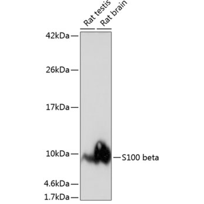 S100B Rabbit Monoclonal Antibody