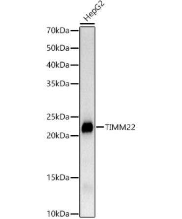 TIMM22 Rabbit Monoclonal Antibody
