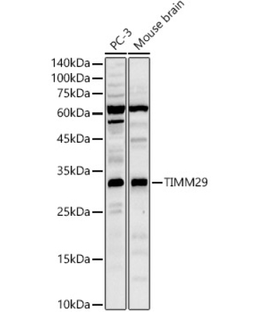 TIMM29 Rabbit Polyclonal Antibody