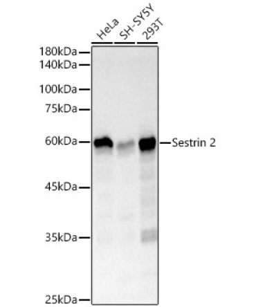 Sestrin 2 Rabbit Monoclonal Antibody