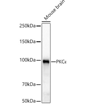 PKC? Rabbit Monoclonal Antibody