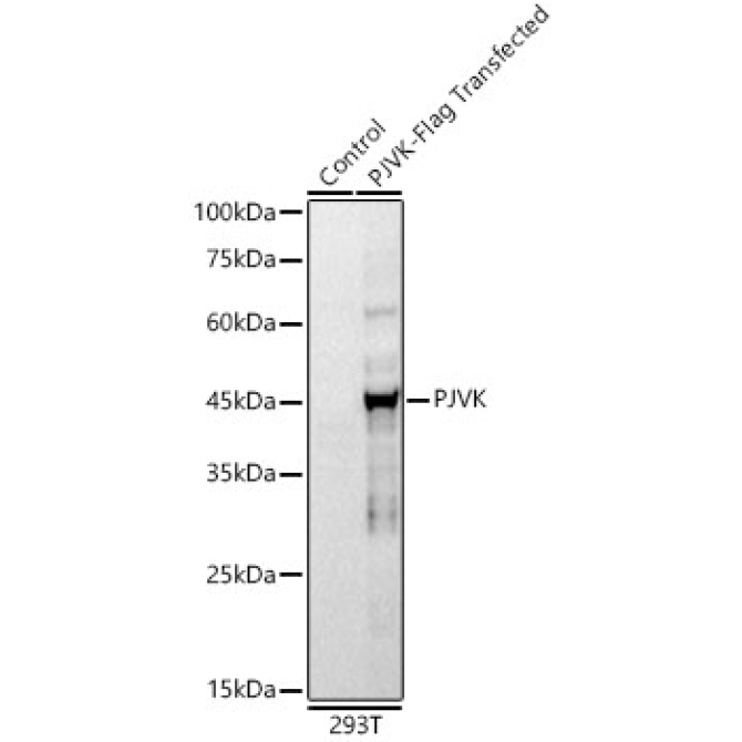 PJVK Rabbit Monoclonal Antibody