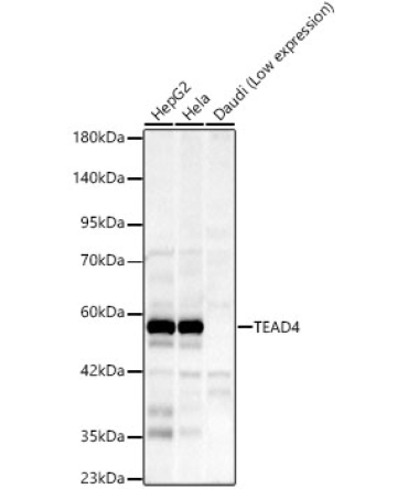 TEAD4 Rabbit Monoclonal Antibody