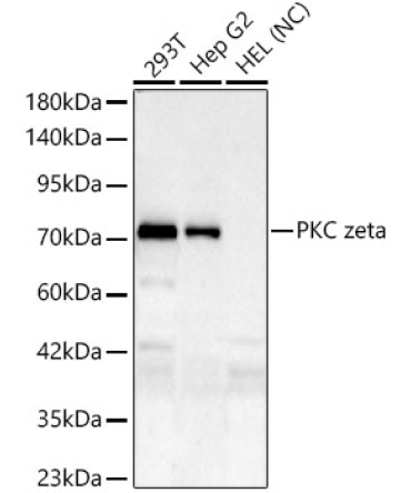 PKC zeta Rabbit Monoclonal Antibody