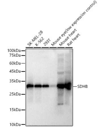 SDHB Rabbit Monoclonal Antibody