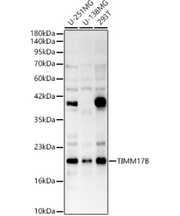 TIMM17B Rabbit Polyclonal Antibody