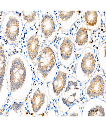 SLC25A29 Rabbit Polyclonal Antibody