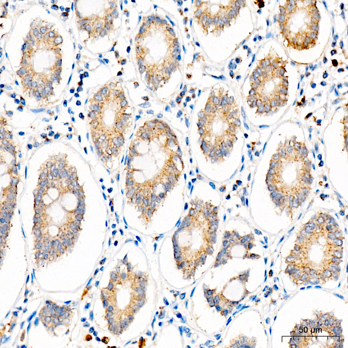 SLC25A29 Rabbit Polyclonal Antibody
