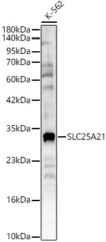 SLC25A21 Rabbit Polyclonal Antibody