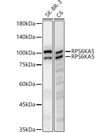 RPS6KA5 Rabbit Monoclonal Antibody