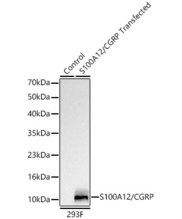 S100A12/CGRP Rabbit Monoclonal Antibody