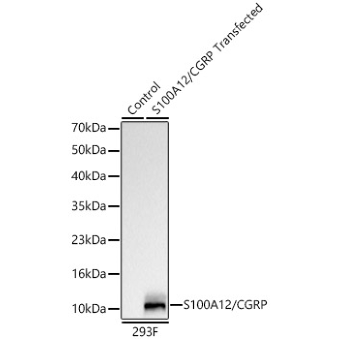 S100A12/CGRP Rabbit Monoclonal Antibody