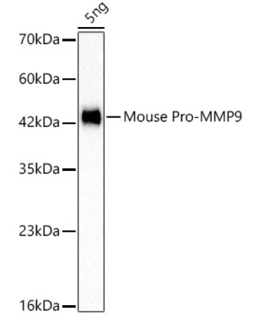 Pro-MMP9 Rabbit Monoclonal Antibody