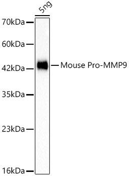 Pro-MMP9 Rabbit Monoclonal Antibody