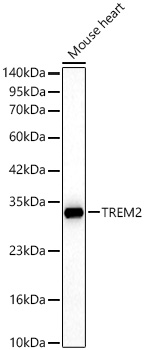 TREM2 Rabbit PolyMonoclonal Antibody?