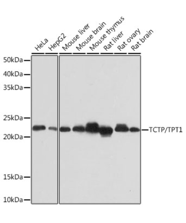 TCTP/TPT1 Rabbit Monoclonal Antibody