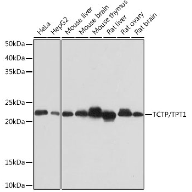 TCTP/TPT1 Rabbit Monoclonal Antibody