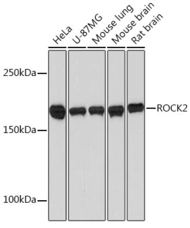 ROCK2 Rabbit Monoclonal Antibody