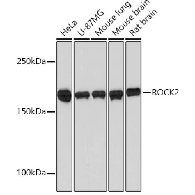 ROCK2 Rabbit Monoclonal Antibody