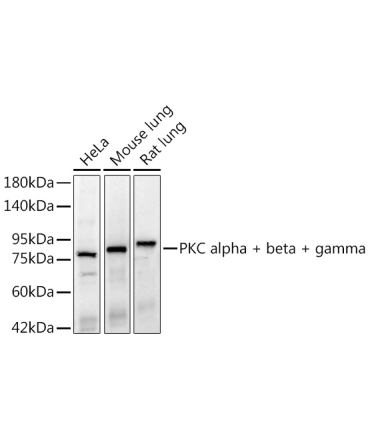 PKC alpha + beta + gamma Rabbit Monoclonal Antibody