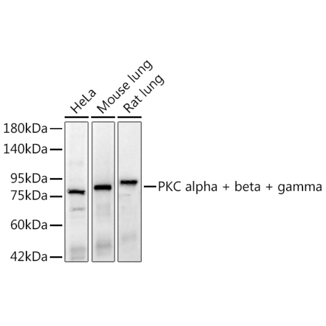 PKC alpha + beta + gamma Rabbit Monoclonal Antibody
