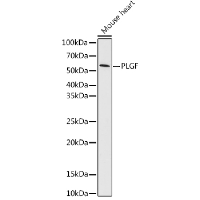 PLGF Rabbit Monoclonal Antibody