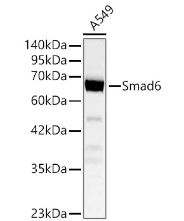 Smad6 Rabbit Polyclonal Antibody