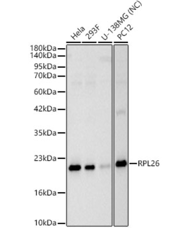 RPL26 Rabbit Polyclonal Antibody