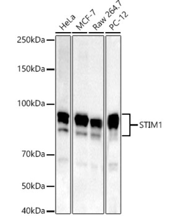 STIM1 Rabbit Monoclonal Antibody