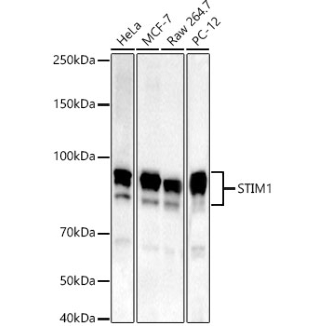 STIM1 Rabbit Monoclonal Antibody