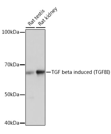 TGF beta induced (TGFBI) Rabbit Monoclonal Antibody