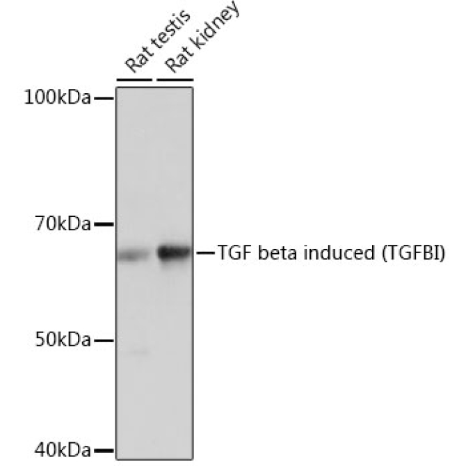 TGF beta induced (TGFBI) Rabbit Monoclonal Antibody